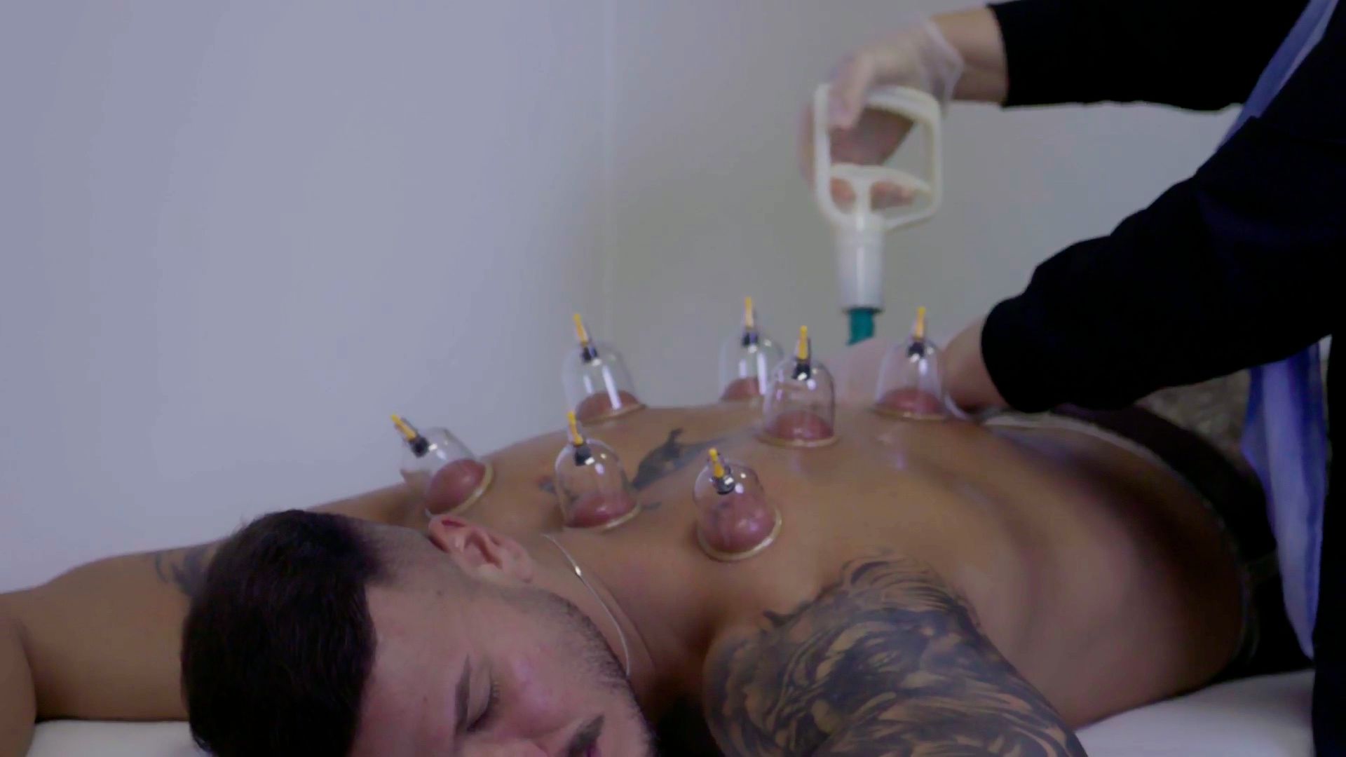 A client lying face down while cups are placed with gentle suction along his back